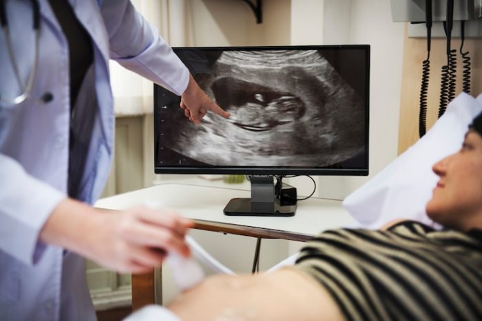 dokter kandungan memeriksa USG ibu hamil